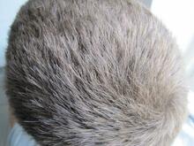 Gråt hår der spreder sig Gråt hår